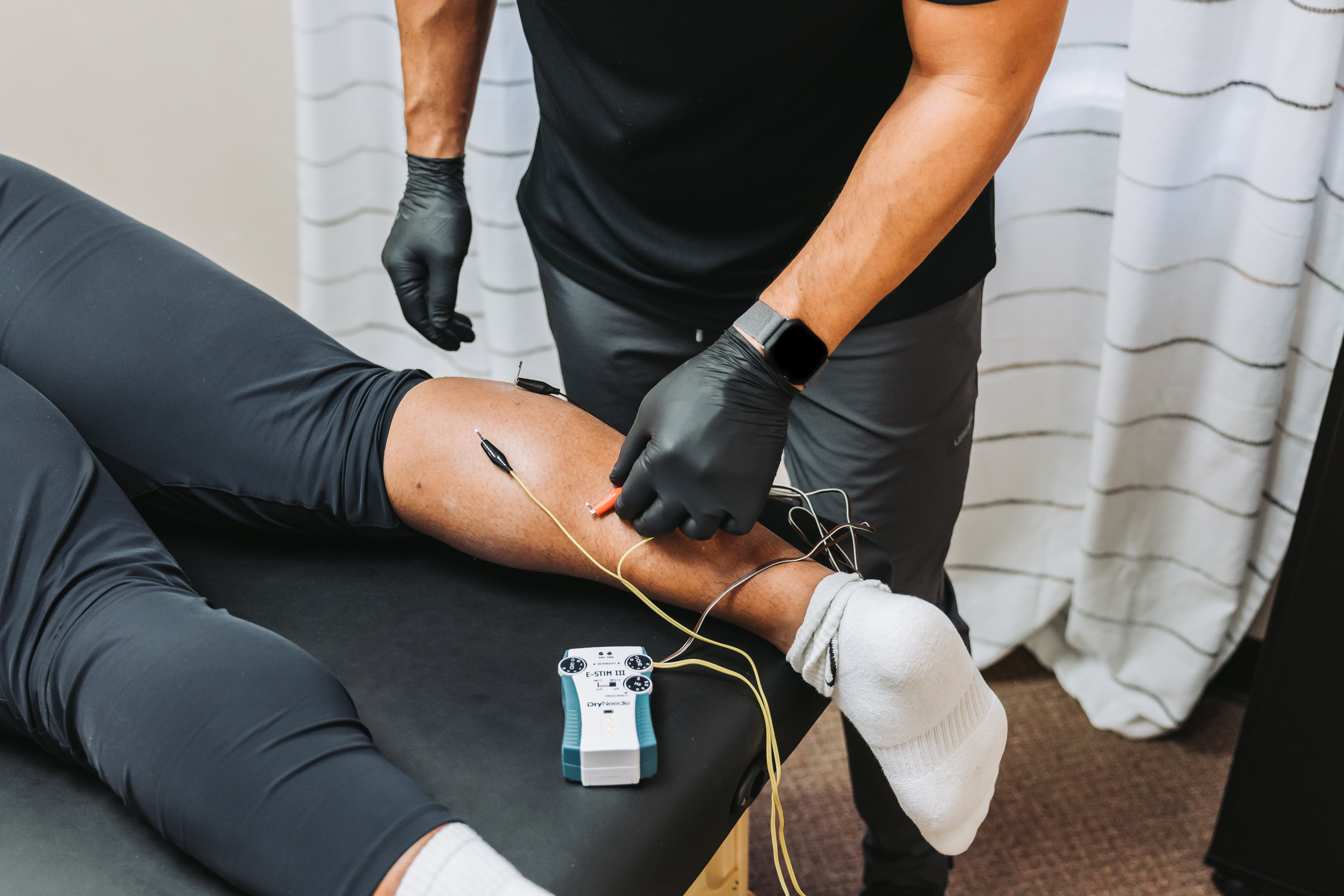 Dry Needling Calf of Patient